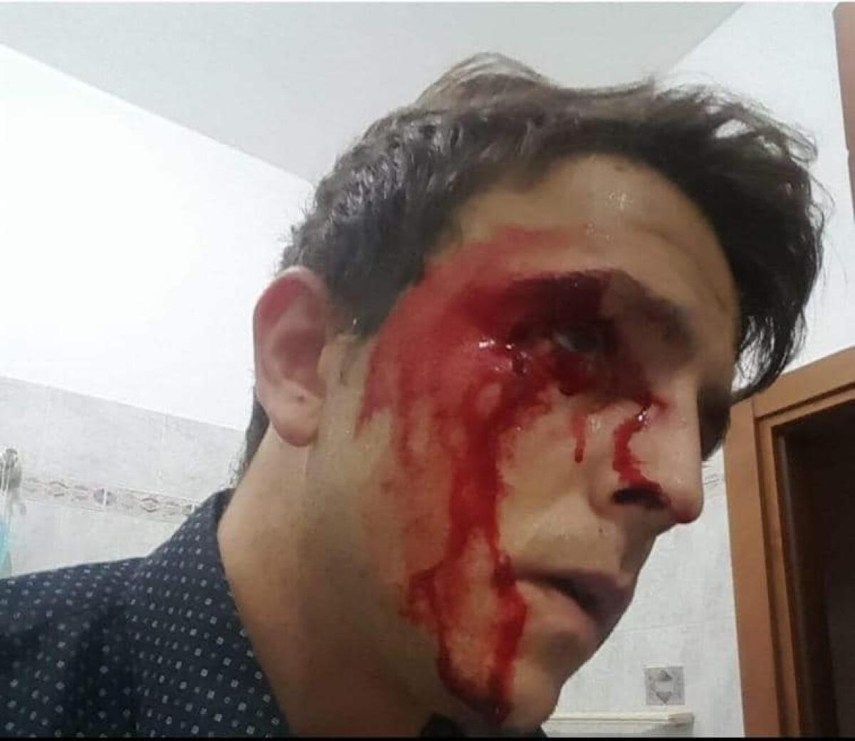 PONZA - Aggredito brutalmente il dirigente di FdI Danilo D’Amico, è la seconda volta. Solidarietà da Giorgia Meloni. - 