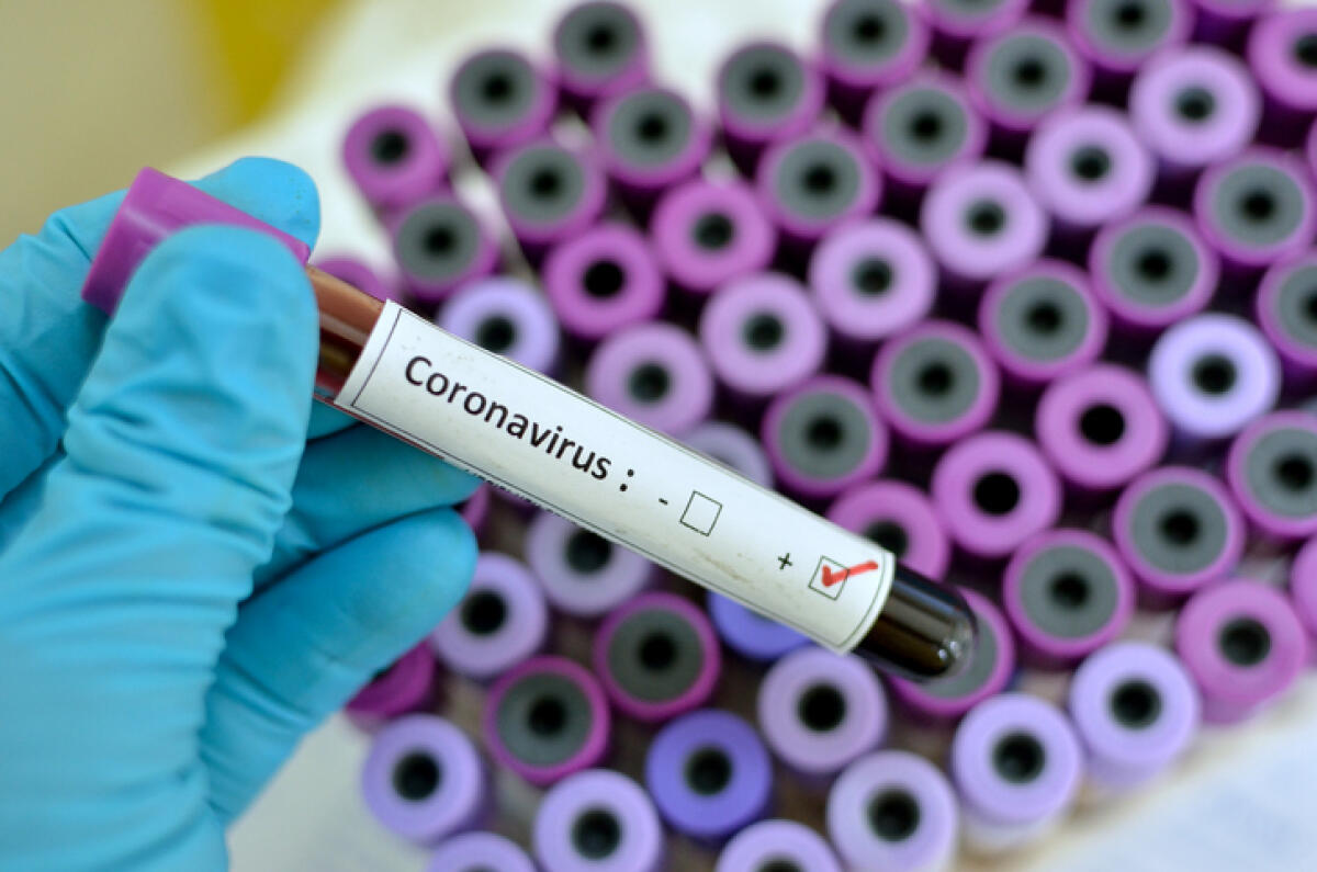Coronavirus, muore 69enne di Pomezia ospite di una rsa di Aprilia - 