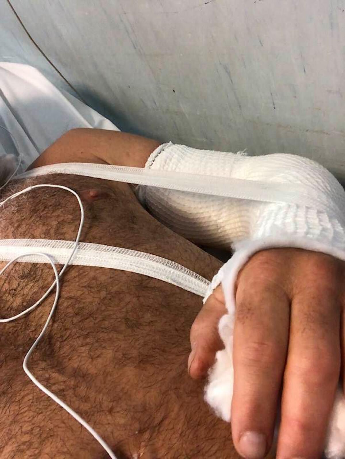 Sub travolto da un gommone alle Grotte di Nerone ad Anzio: "Se qualcuno ha visto denunci alla Capitaneria" - 