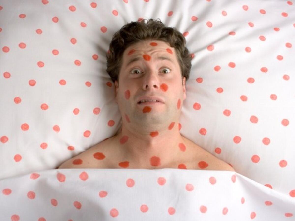 "Morbillo e rosolia, da aprile 2020 nessun caso" - 