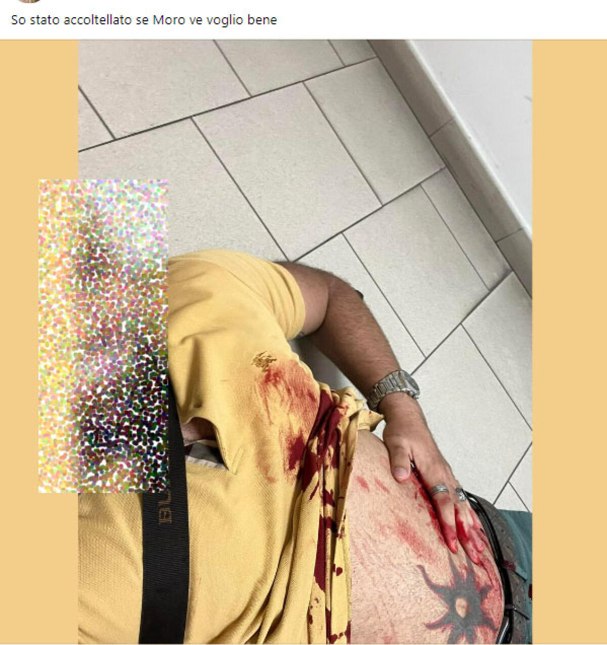 "So stato accoltellato se moro ve voglio bene": il post di uno dei due bodyguard aggrediti dal papà di Leonardo Muratovic - 