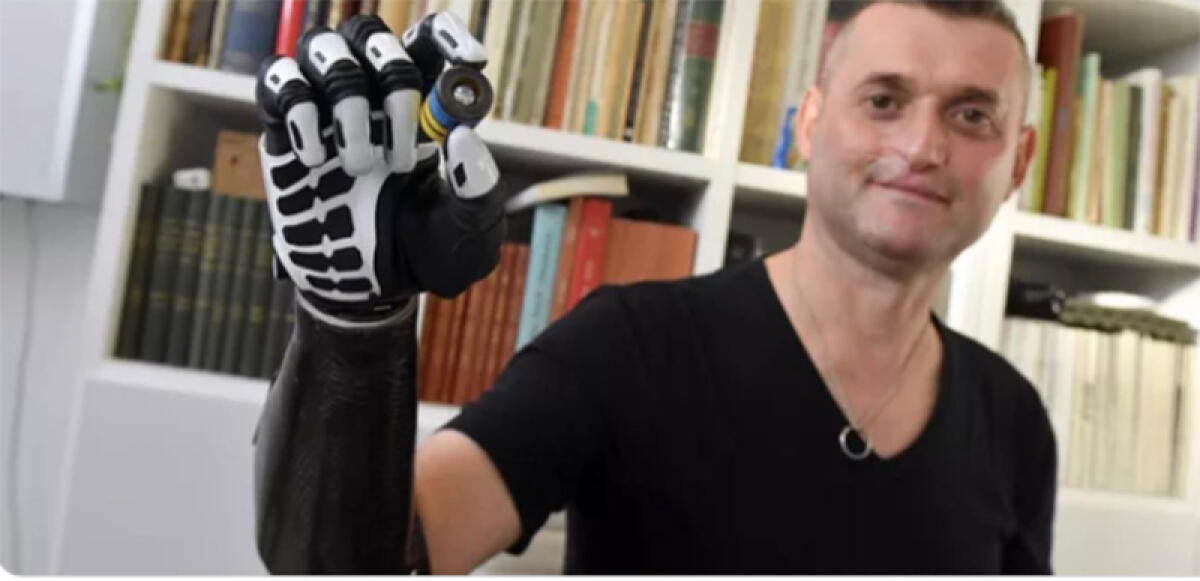 Fabio Carlesso ce l'ha fatta: raccolti 60mila euro per acquistare le mani ultra tecnologiche - 