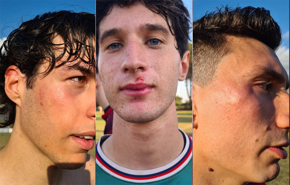 Scontri in campo al “Galamini” di Cisterna durante la partita Doganella-La Setina: il Giudice Sportivo squalifica 10 giocatori. - 