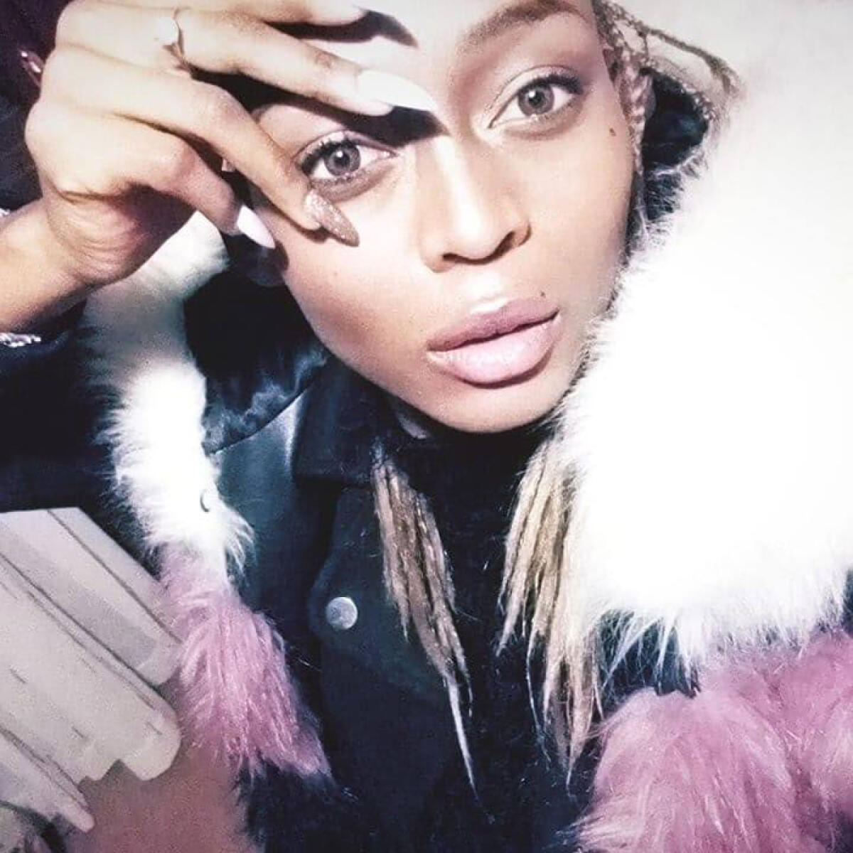 LATINA - Assalita e uccisa da un branco di pitbull, autopsia sul corpo di Patricia: una morte atroce. Martedì i funerali. - 