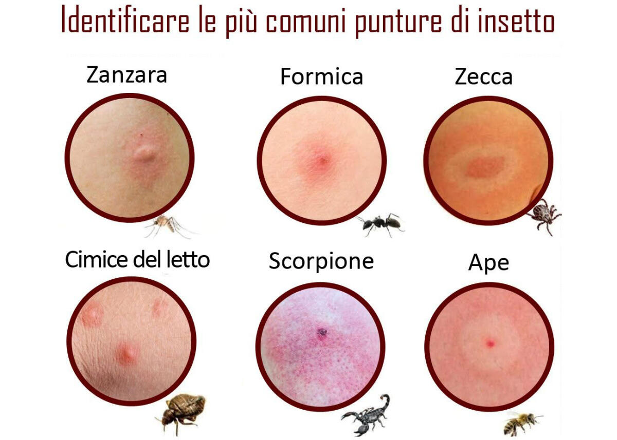 Punture di insetti, ecco come riconoscerle e cosa fare! I consigli della Croce Rossa di Aprilia - 