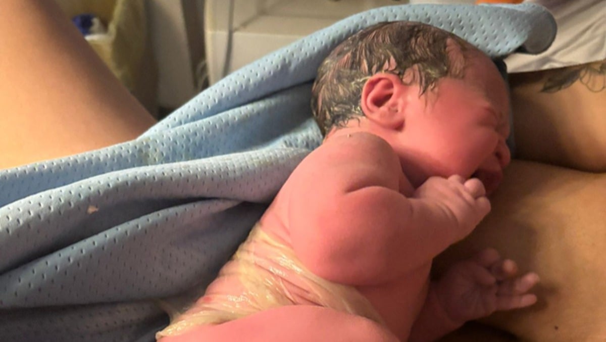 All’ospedale Città di Aprilia nasce una bambina “con la camicia”: un evento rarissimo. - 