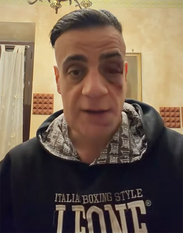 Pestarono il noto youtuber Cicalone e due guardie giurate alla Metro Ottaviano: in 4 arrestati dalla Polizia. - 