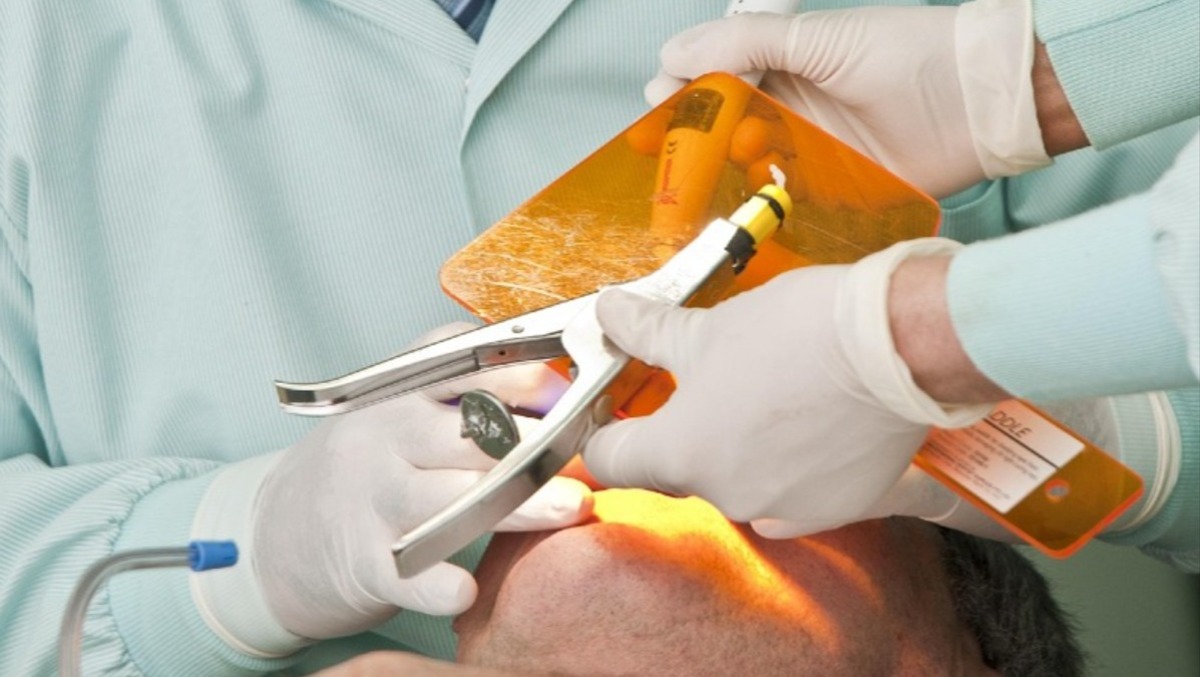 Dentista abusivo, sequestrato uno studio in provincia di Latina.