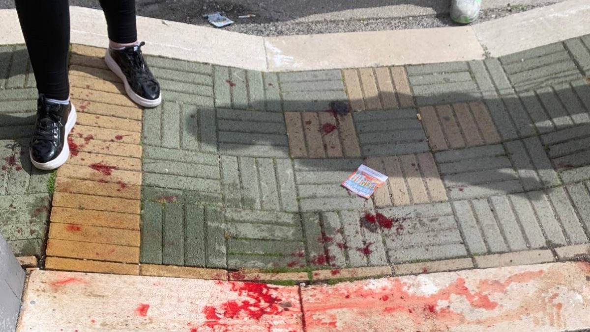 APRILIA - 17ENNE COLPITO AL VOLTO, FRATTURATA LA MANDIBOLA. PAURA IN CENTRO: "Il responsabile già libero" - 