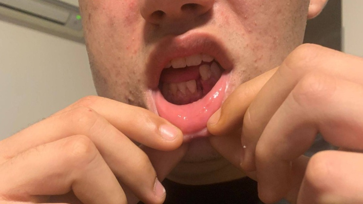 17enne pestato ad Aprilia. “Si chiede più sicurezza”. - 