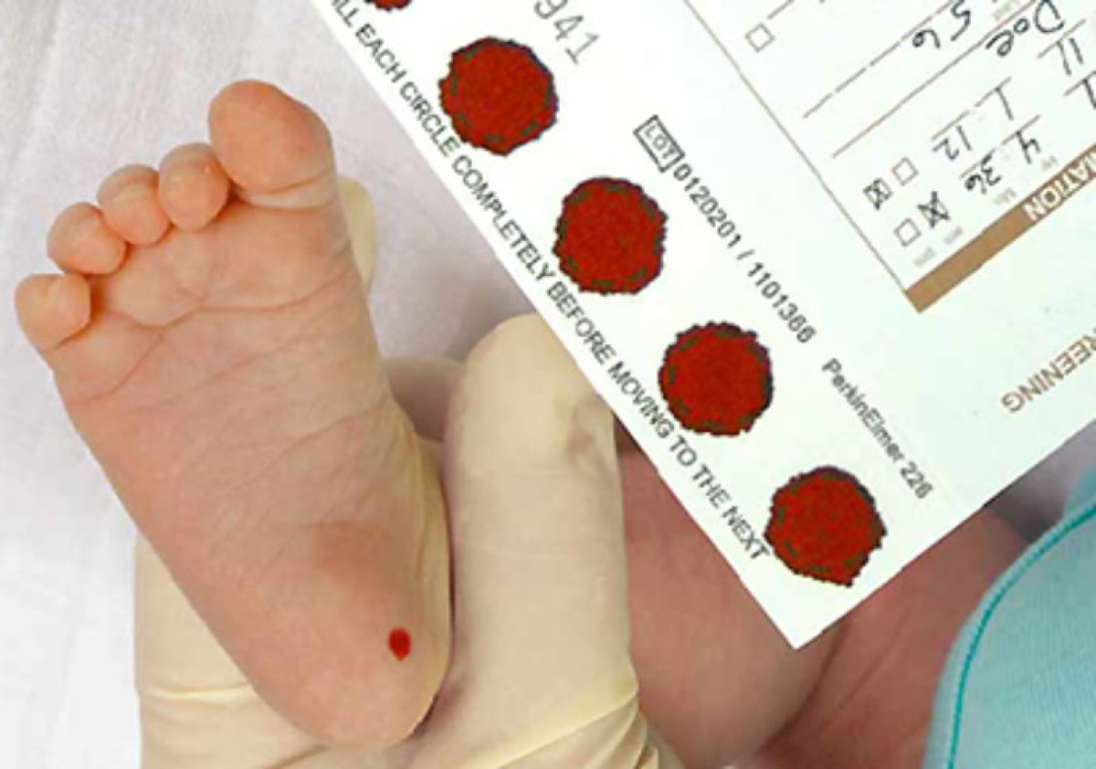 Screening Neonatale Esteso, il documento dell'Osservatorio Malattie Rare per la presa in carico - 